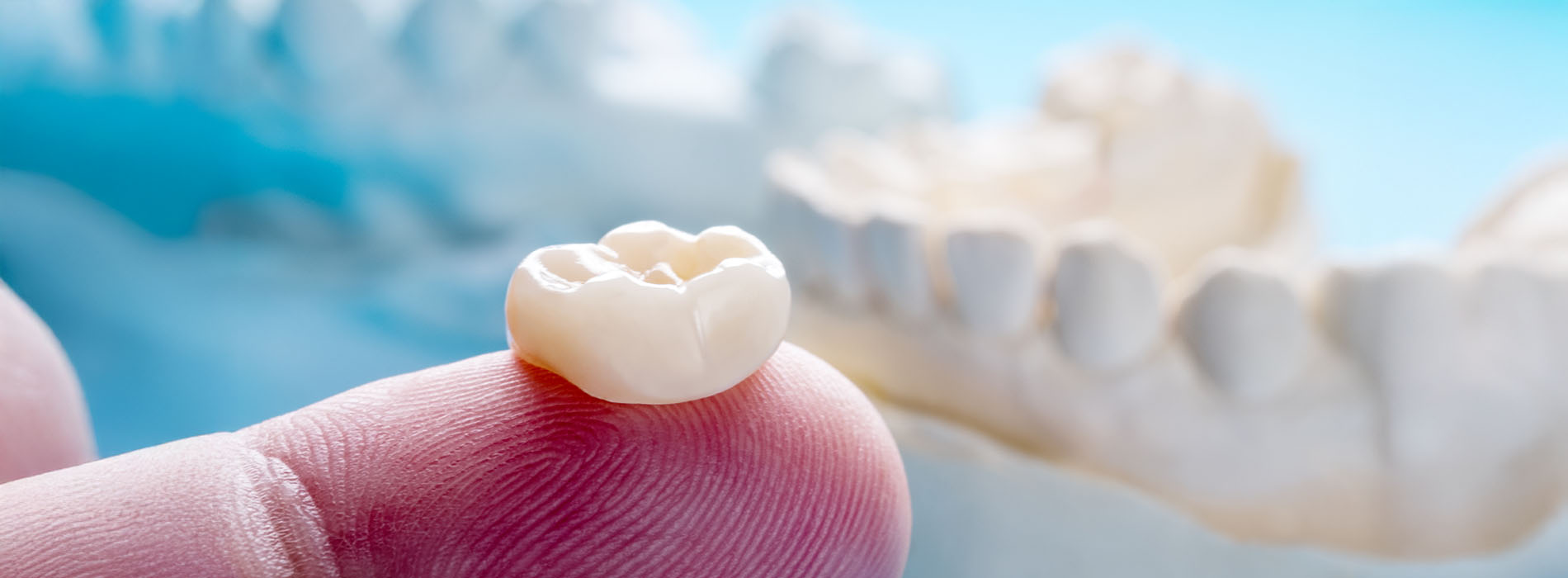 Lighthouse Kids Dental | Fluoride Treatments, Habit Counseling and Oral Health Education