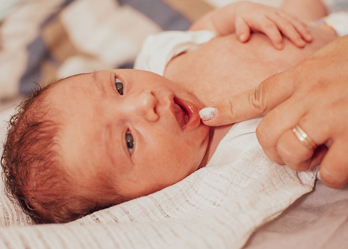 Lighthouse Kids Dental | Frenectomy, Dental Sealants and Baby Molar Crowns