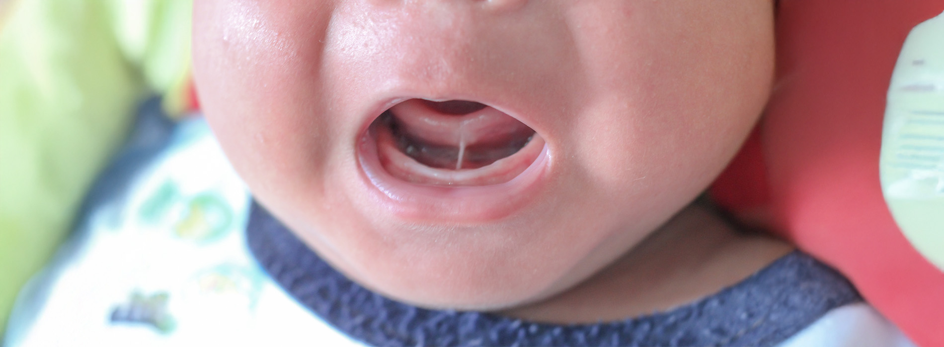 Lighthouse Kids Dental | Fluoride Treatments, Emergencies and Dental Sealants