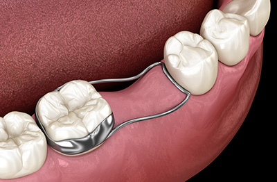 Lighthouse Kids Dental | Exams and Cleanings, Emergencies and Your Child s First Dental Visit