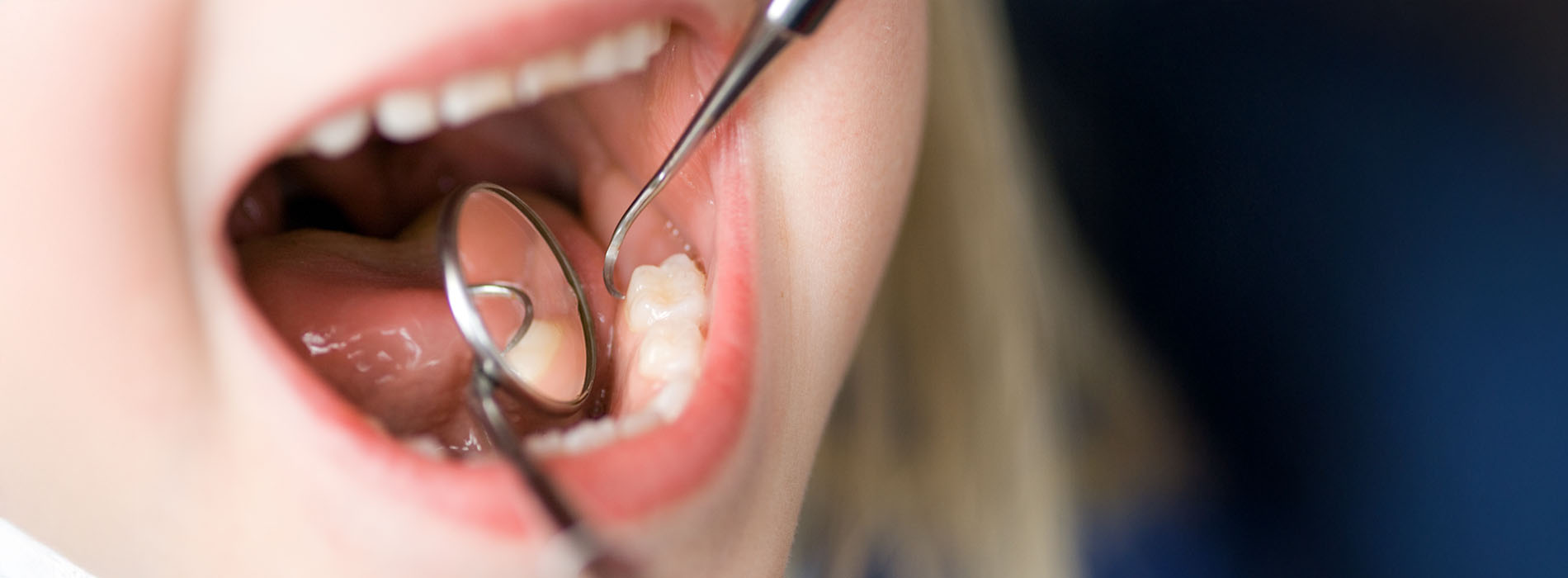 Lighthouse Kids Dental | Crowns for Children, Digital Radiography and Space Maintainers